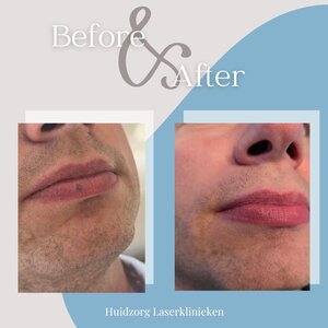 Huidzorg Laserklinieken Eindhoven- Best image 1