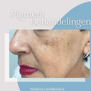 Huidzorg Laserklinieken Den Bosch image 3